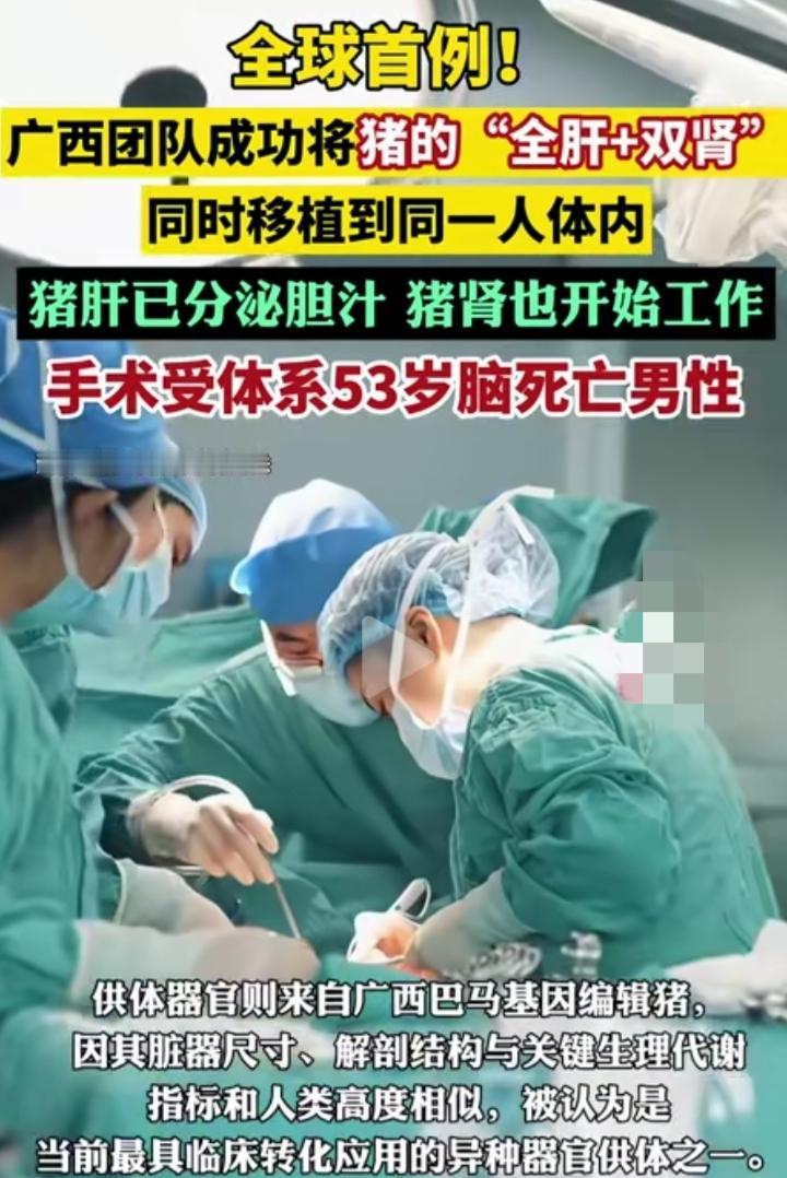 炸裂！广西团队把猪肝肾一起移植给人，太敢玩了！
 
这两天被广西医疗圈的操作惊到