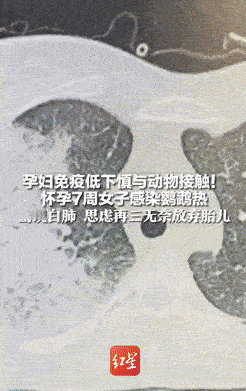 代价太大了！四川成都，一孕妇网购了一只鹦鹉，想着平时能解解闷，不料，在照顾了鹦鹉