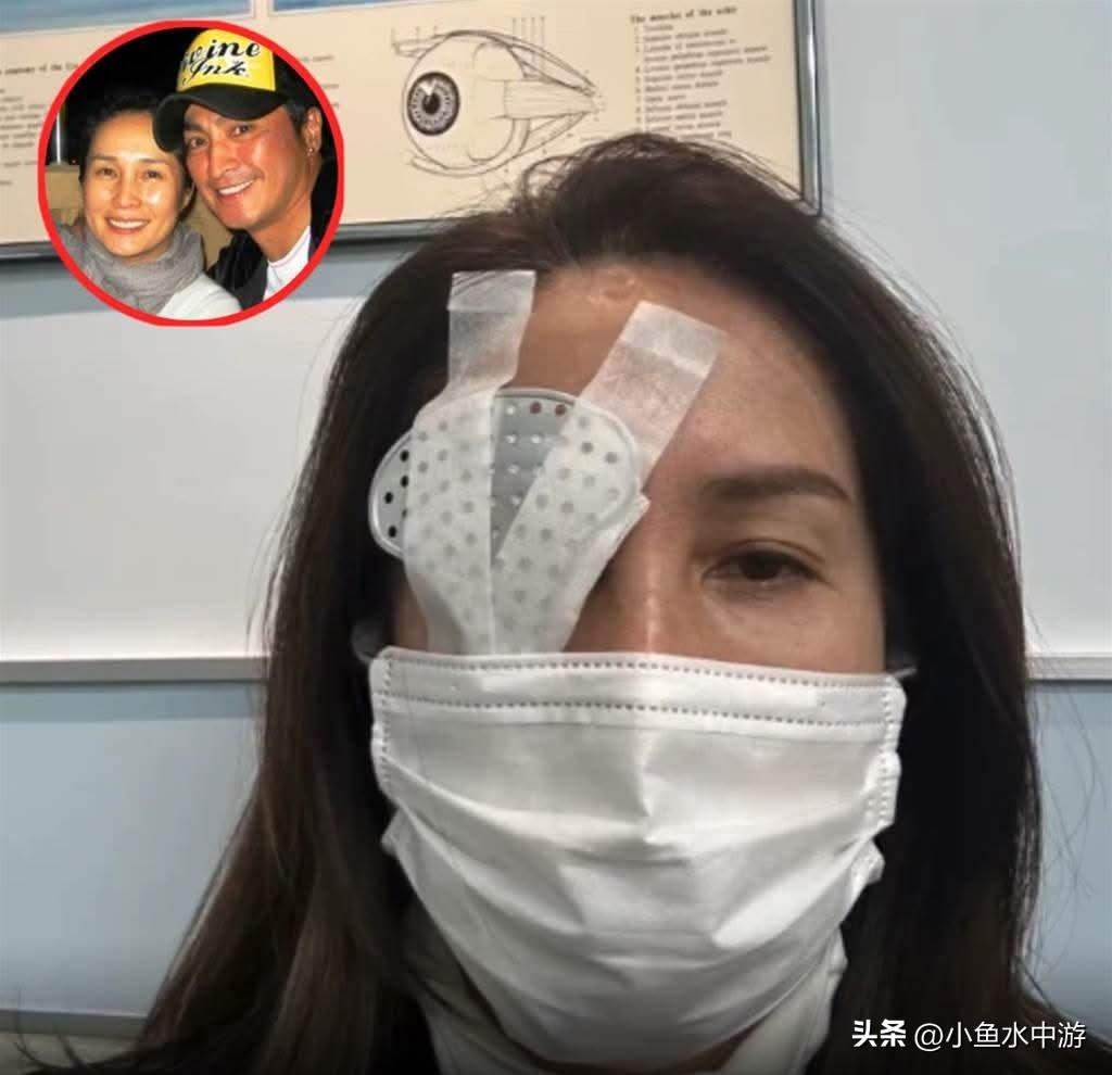 退圈25年！高金素梅突然公开“独眼照”，健康亮起红灯，开刀前的一个举动让全网心疼