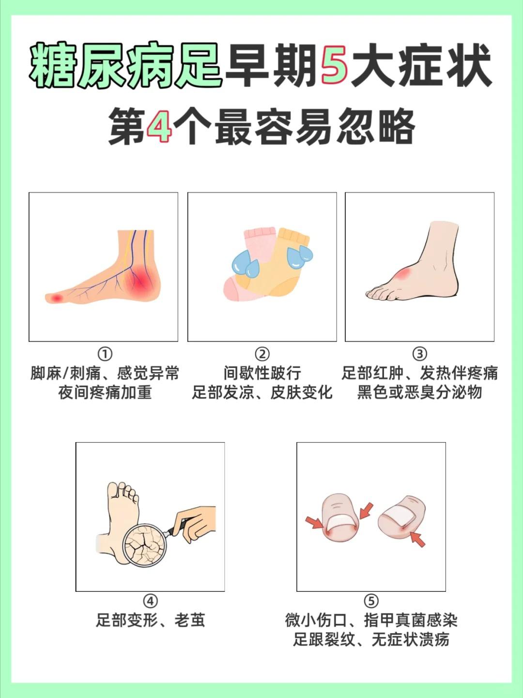 糖尿病足早期5大症状，第4个最容易忽略！