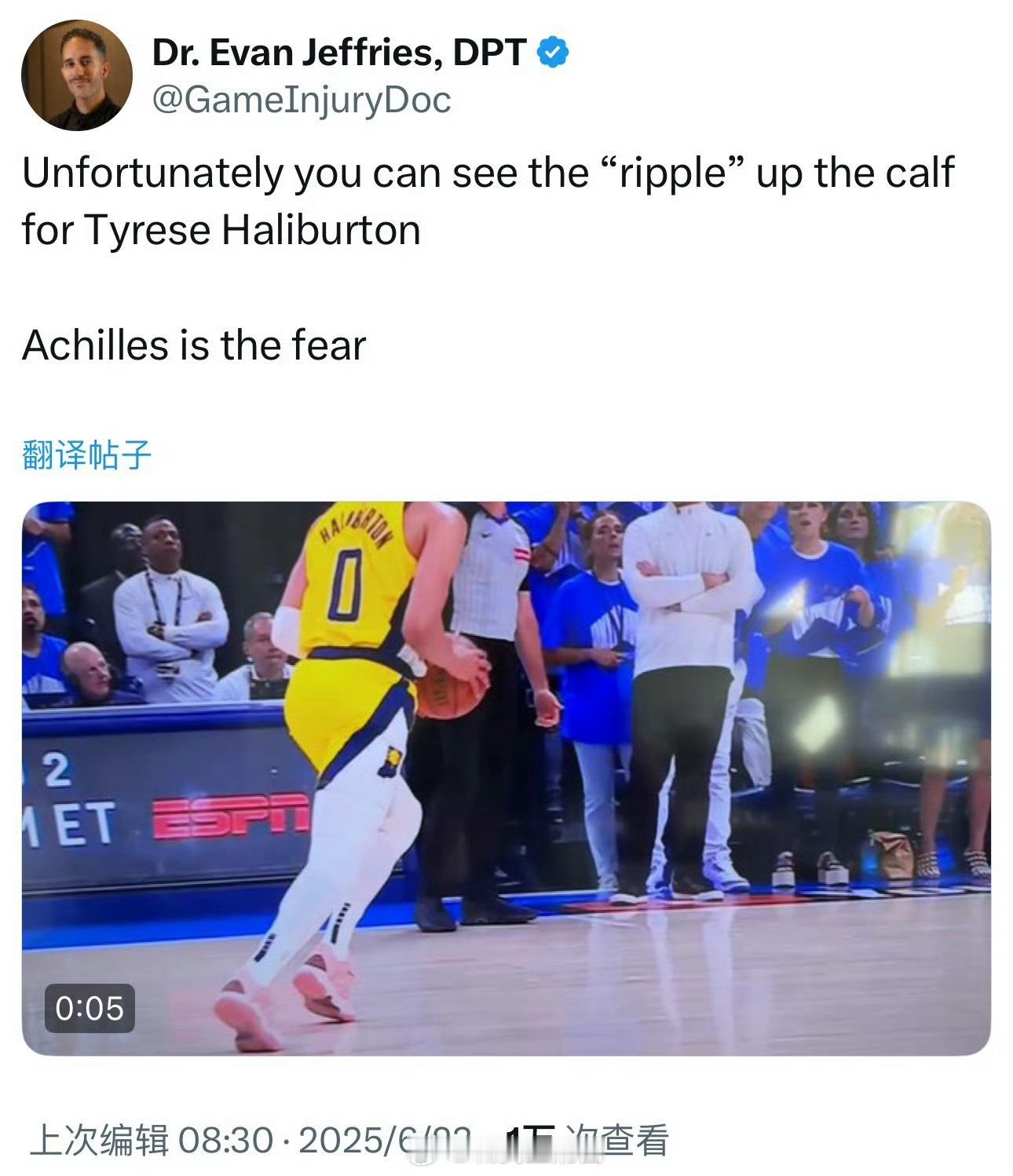 哈利伯顿受伤NBA今年的季后赛好几个受伤的了吧，大多数人的质疑都是赛程的安排！赛