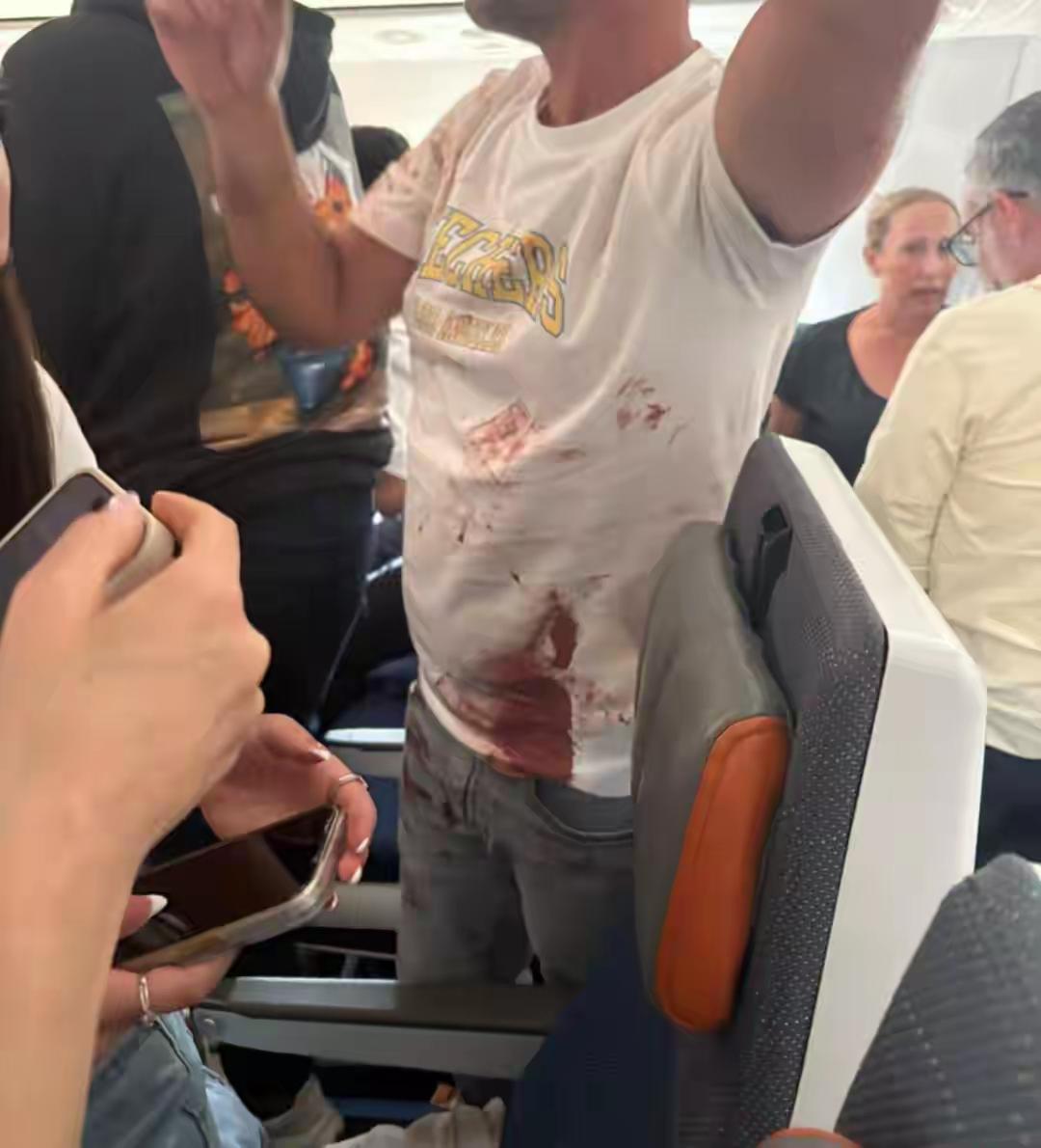 ​很难想象，副驾驶员竟然会对机长下此毒手。在一架飞往迪拜的航班中，座满了大量的以