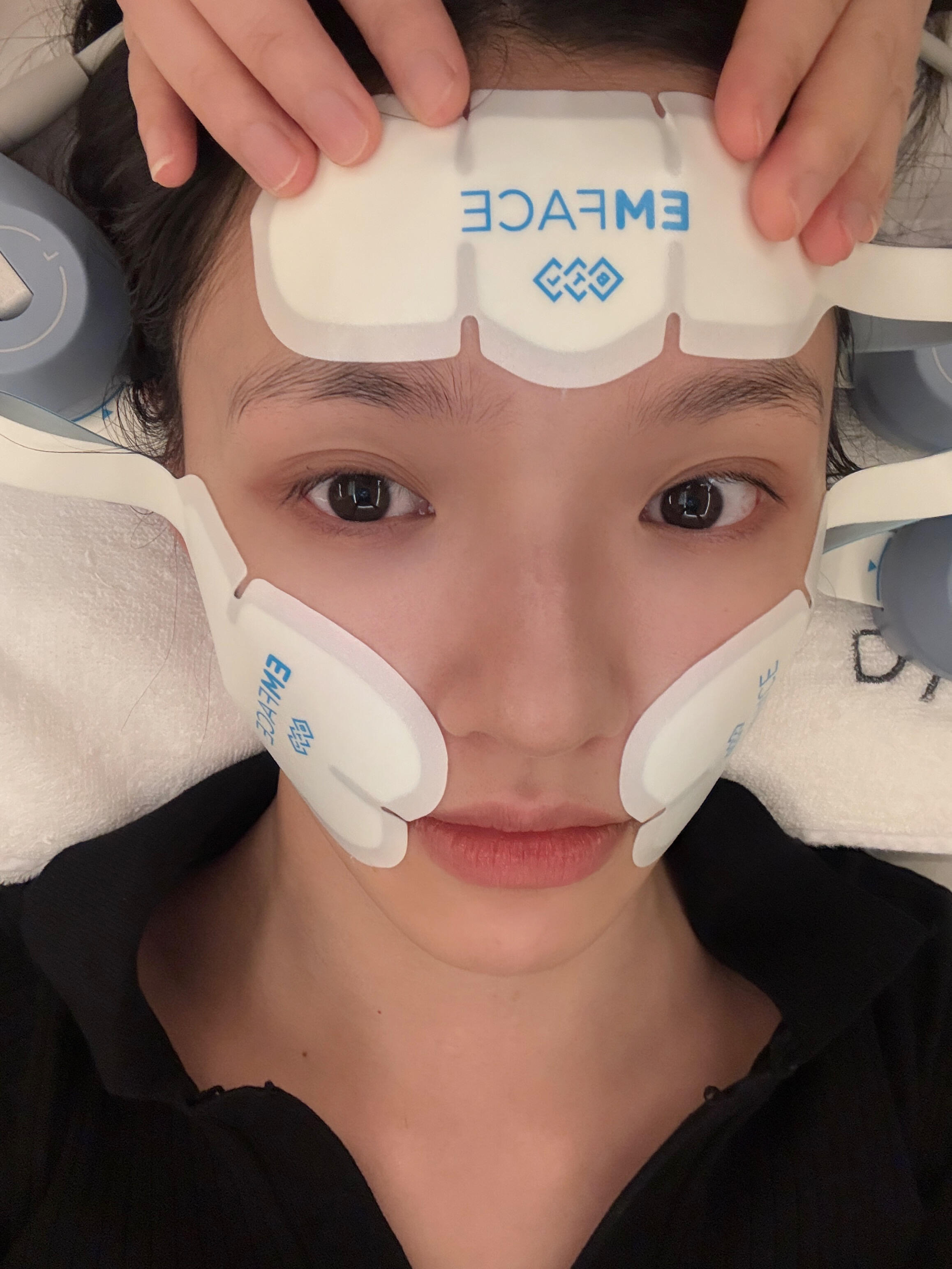真的很喜欢林允这种又美又real的人，我的医美启蒙劳斯[抱一抱] ​​​
