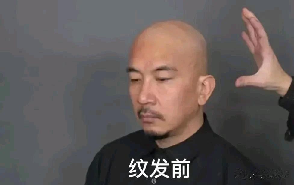 原来大S的老公是个名符其实的大秃脑袋，看到了吧，具俊晔的头发竟然是纹上去的，好逼