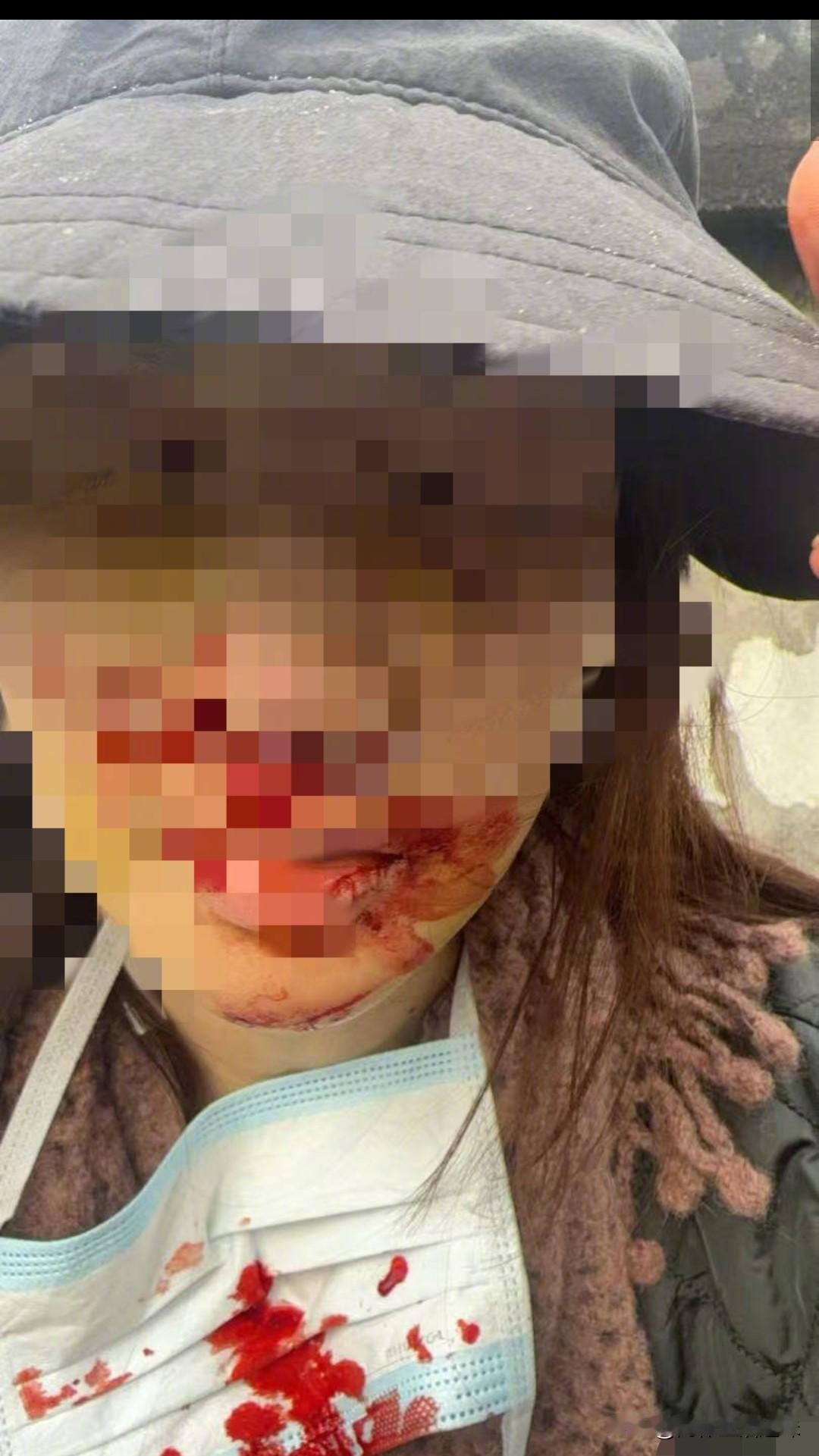 完了
这波“穷追猛打”金晨怕是招架不住了
交警已发布通告
已实证金某驾驶车出了交