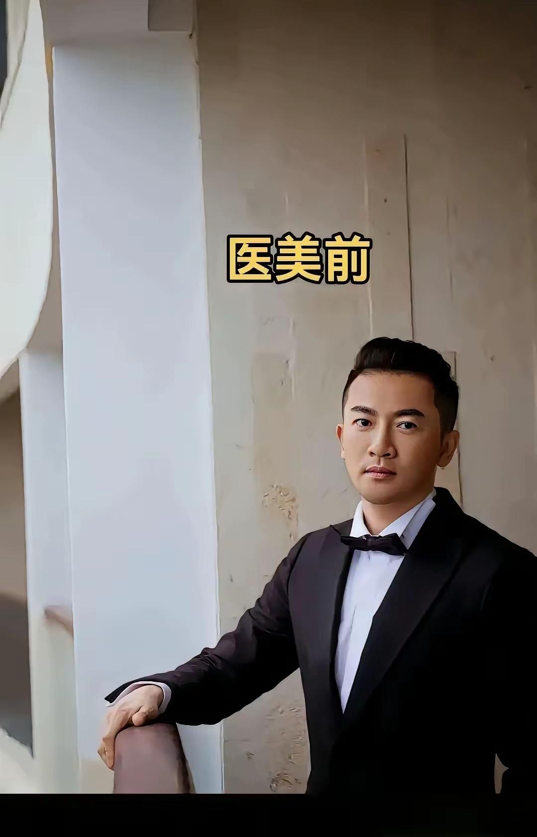 天哪，整容太可怕啦！
连明星整容都成了这副模样，你说说咱们普通人还敢整吗？
他们