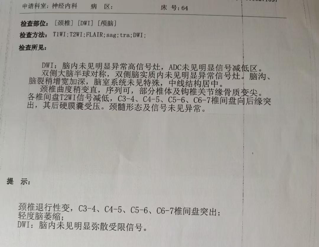 头晕了3年多，住院花了几千都没治好，没想到近几天找到了病因，而且只花了180元，