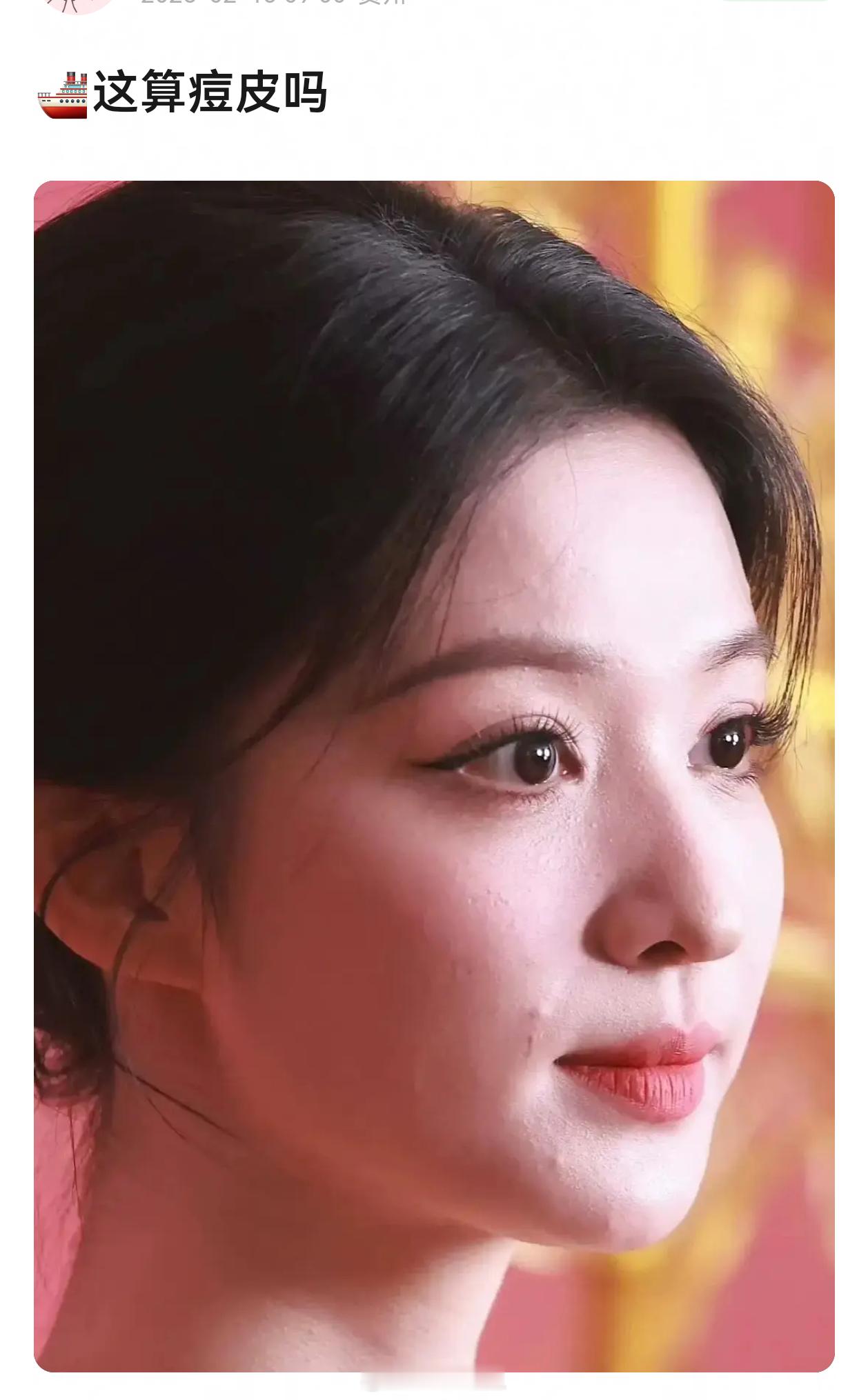 王楚然这是人的正常皮肤，是不是磨皮看多了都不知道人脸上有纹路也会长痘了 