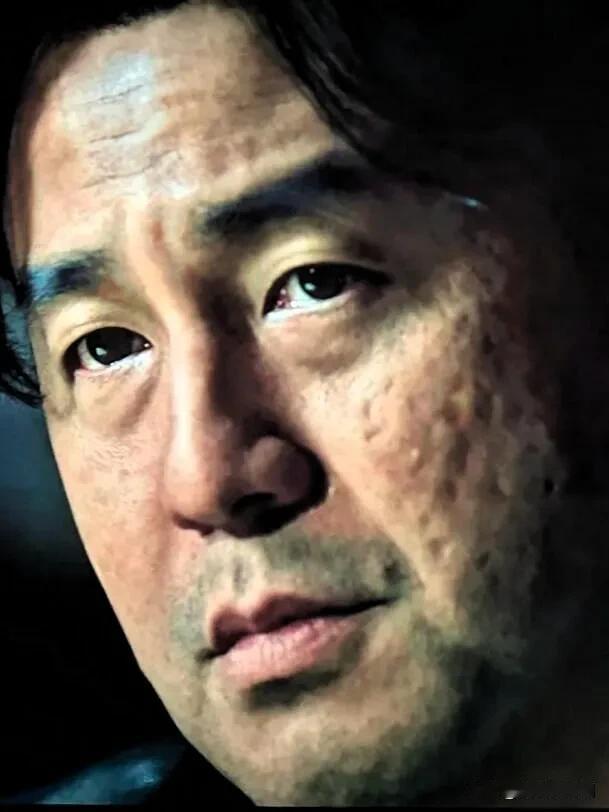 雷佳音你还是别拍电影了，不是你的演技问题，而是你那张满脸橘皮坑洼、浮肿到变形的脸