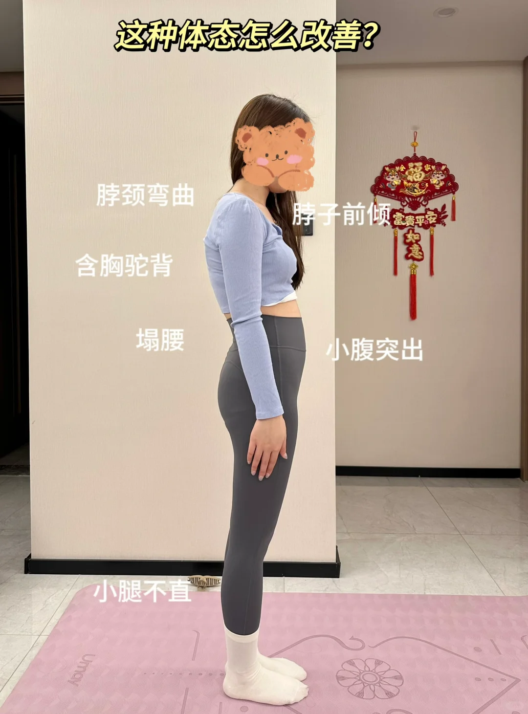 说句大实话❗这种体态很好调整