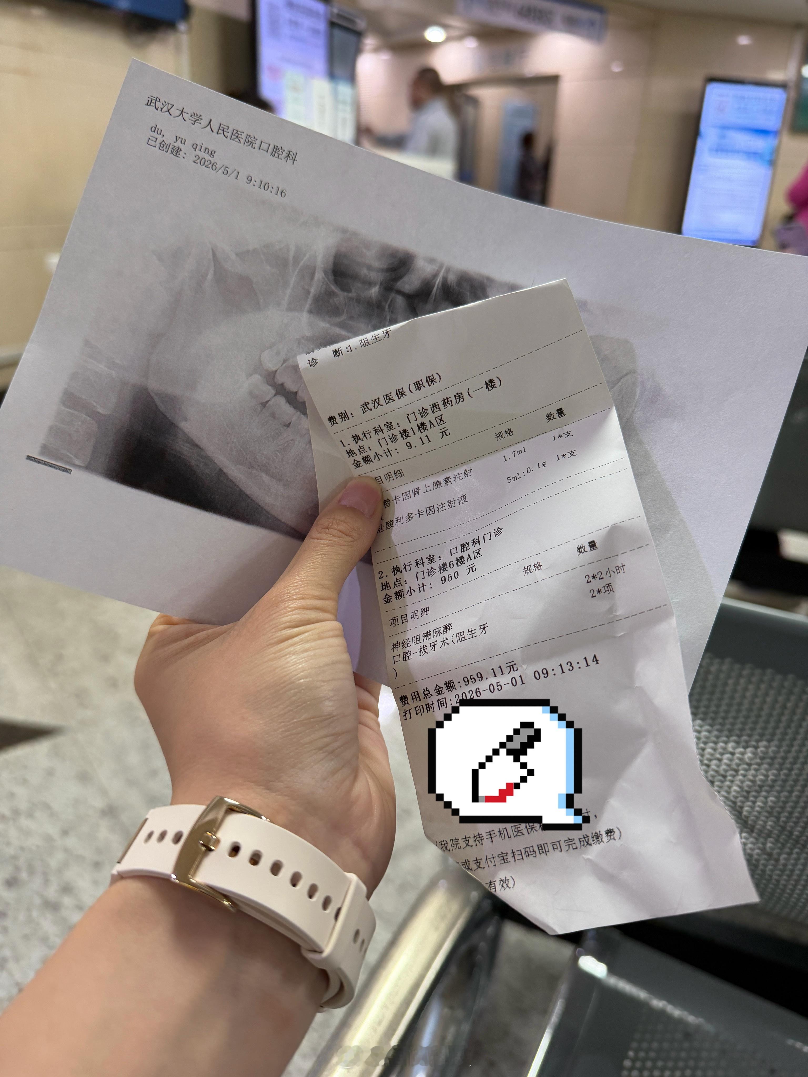 五一一大早就来把🦷给拔了正好放假在家消肿 不影响拍摄