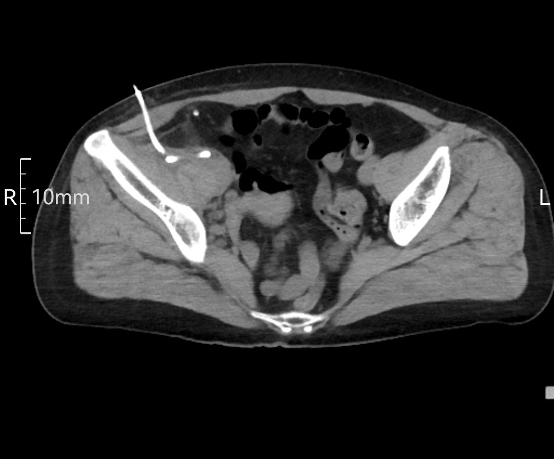 这周急诊有点多，连续4天都有急诊，今天特别多，今天出差下午三点回来，接...