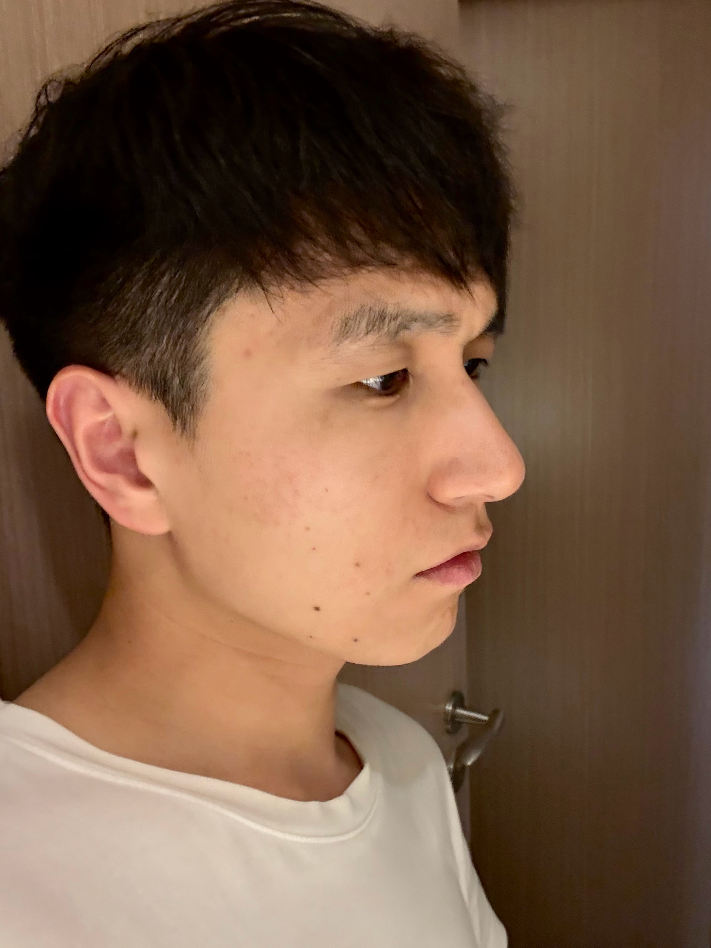 刘海放下去可以减龄吗？ 