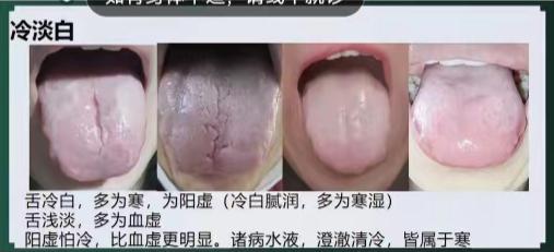 舌诊基础知识分享，每天学一点，看着看着就会了[给力][给力][给力]