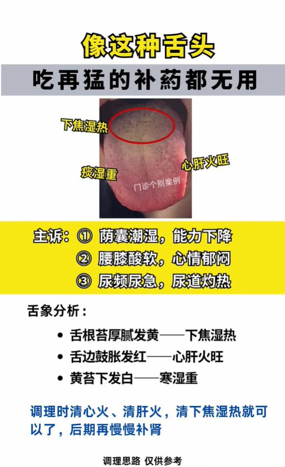 下焦湿热舌象，先清后补别乱补