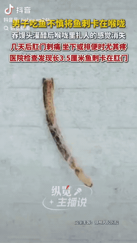 一45岁男子吃鱼不慎被鱼刺卡在喉咙里，于是他吞馒头、灌醋硬把鱼刺吞下去了，没想到
