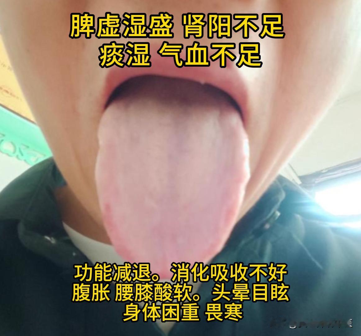 今天有空，可以帮大家看看舌象。

有需要的，尽管把你的舌象照片发过来吧！越早发，