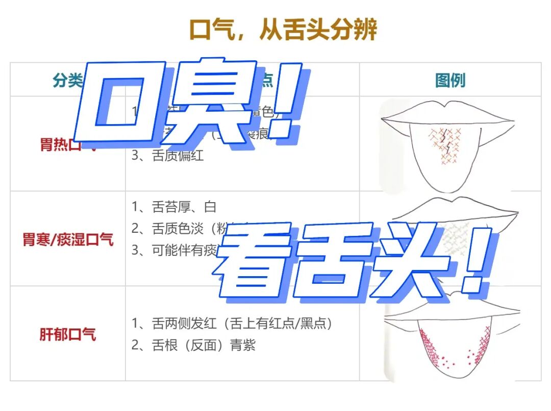 口气口臭👆👆看舌头👅【胃寒｜胃热｜肝郁】