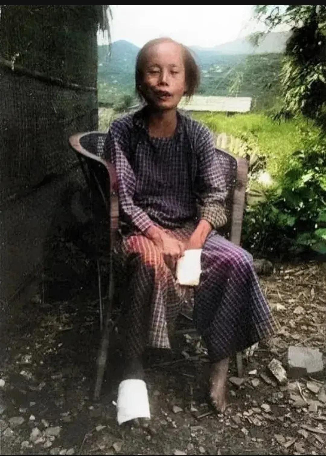 民国时期，一个患“麻风病”的妇女，照片中，她坐在荒郊野外，身边没有任何人陪伴，她