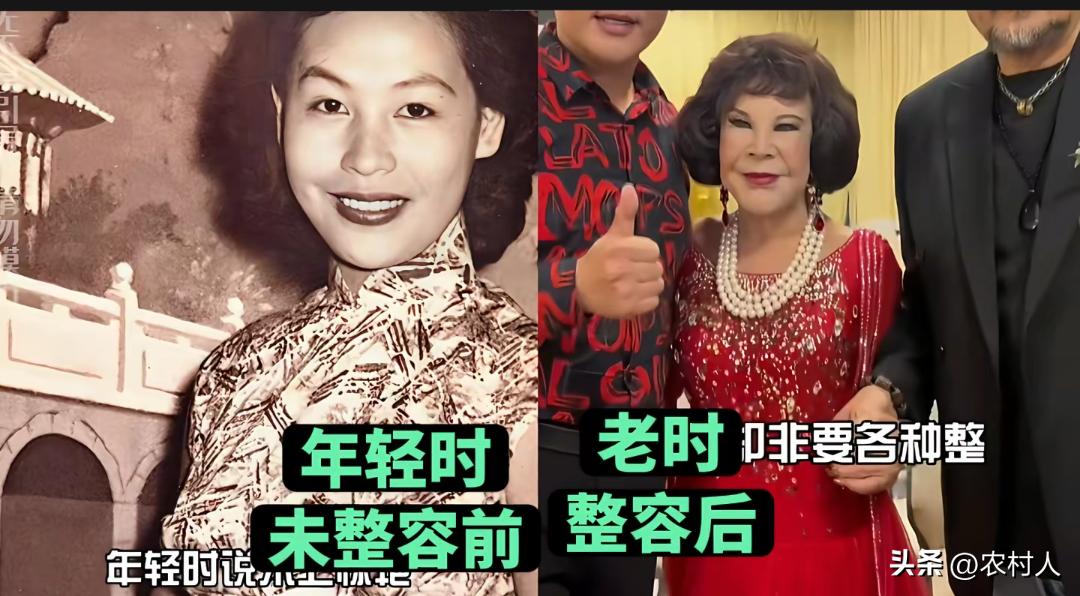 整容需谨慎，老了才知道。希望大家别盲目整容，后遗症非常厉害。网友调侃：原来是人，