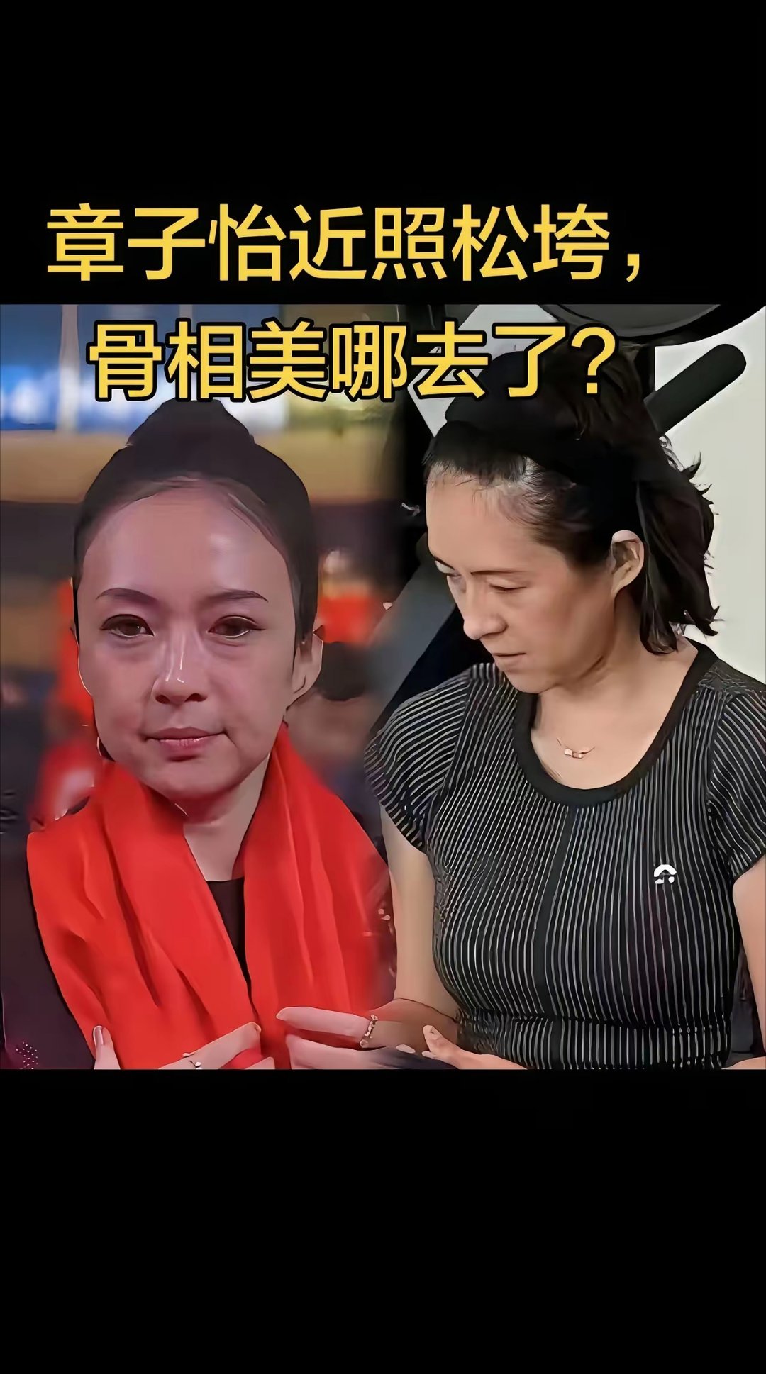 章子怡的脸垮了，按道理不应该啊，她还不到50岁啊。问题她还是骨相美女啊。 ​​​