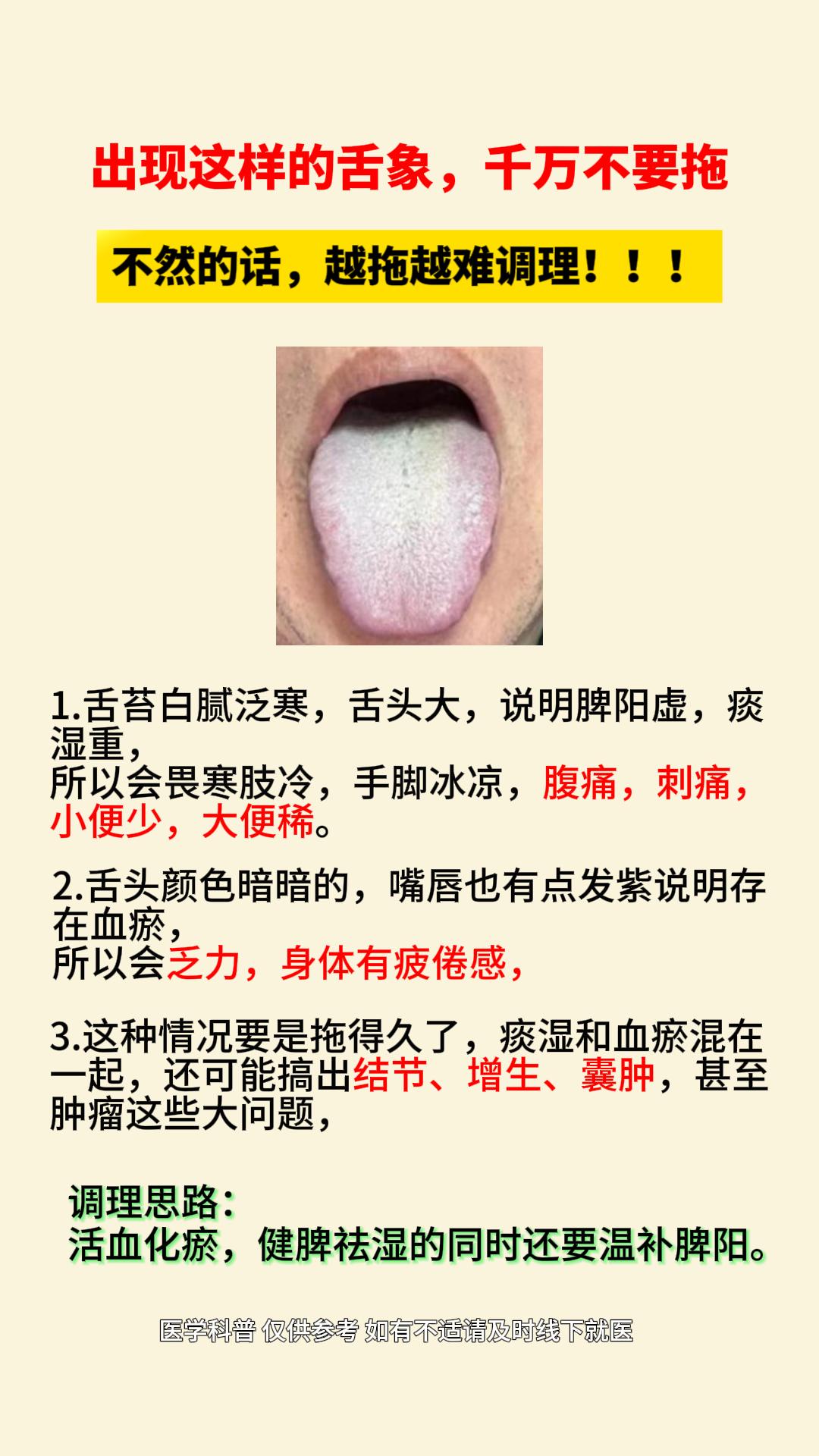 这样的舌头白厚腻腻的，舌头胖大——脾肾阳虚。为啥用了附子理中汤没有作用？
他的舌