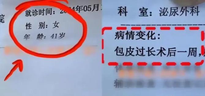 炸裂！江苏女子身体不适，去医院检查被诊断出包皮过长，院方工作人员看完诊断后大笑，