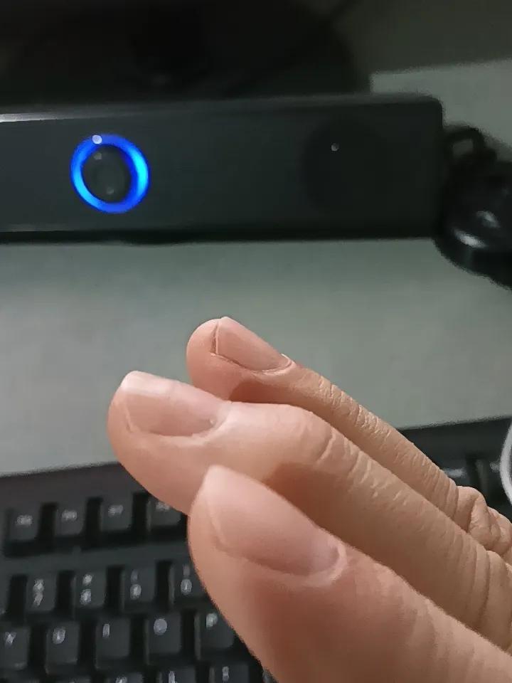 残疾人该怎么生活我认为需要从两个角度看，一是自己的心态要保持健康，二是社会要包容