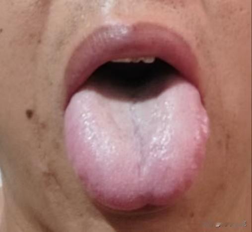 欲望强劲，时间短，你可不是单纯的肾虚，舌边都鼓成这样了，还一个劲的去补，别说金匮