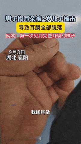 悲剧还是发生了！9月3日，湖北，一男子在家里闲着无聊掏耳朵时，被2岁的儿子突然撞