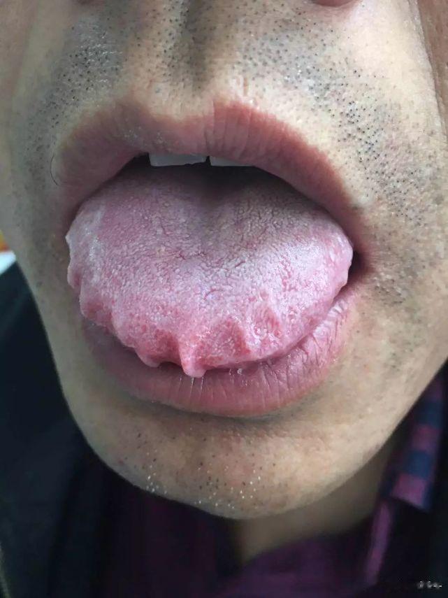 注意夏天喝水，不要猛灌夏天热出汗多，人容易伤到津液，出现口渴，但是很多人喜欢逮住