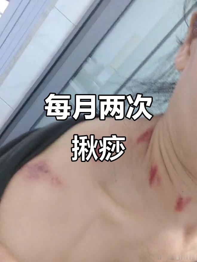 民间手法 “ 揪疙瘩 ”，揪出体内的 “ 沉积物 ”，这些疾病就好了作者：顾建新
