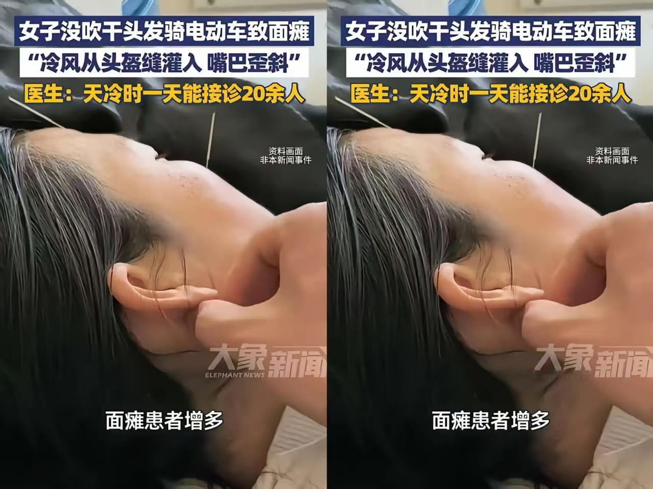 悲剧还是发生了!
河南这位女士的经历，给所有人提了个醒：冬天洗头不吹干就出门，真