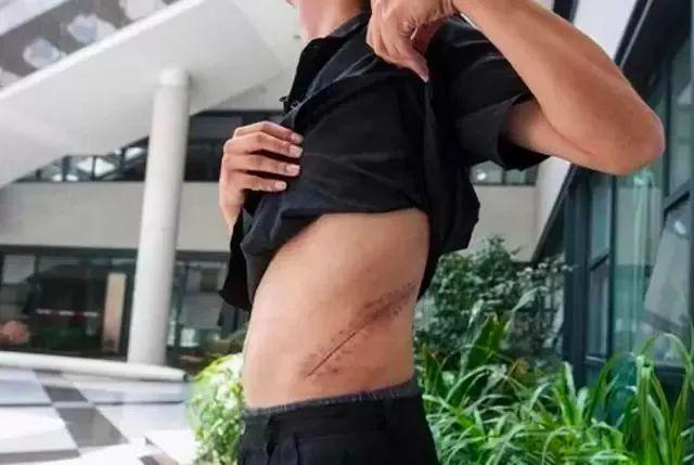 2011年4月，17岁的湖南少年王阳以2万块卖掉了自己的一颗肾，用这笔钱买下了最