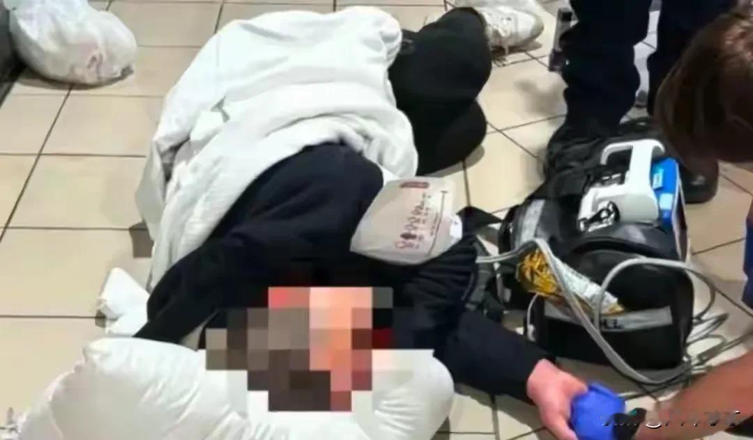 问题到底出在哪里？一名33岁留学生在澳洲被20名未成年人无缘无故殴打造成了重伤！