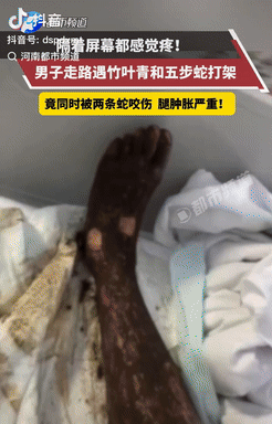 电视剧都不敢这么演！安徽，一男子傍晚散步时，偶遇竹叶青和五步蛇打架，不料，当他从