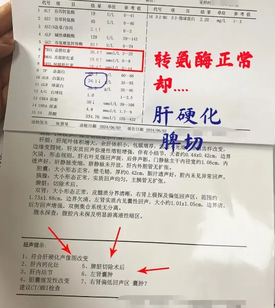 7个异常要警惕，转氨酶正常不代表没肝损伤，谨防病情恶化！  今天接诊了...