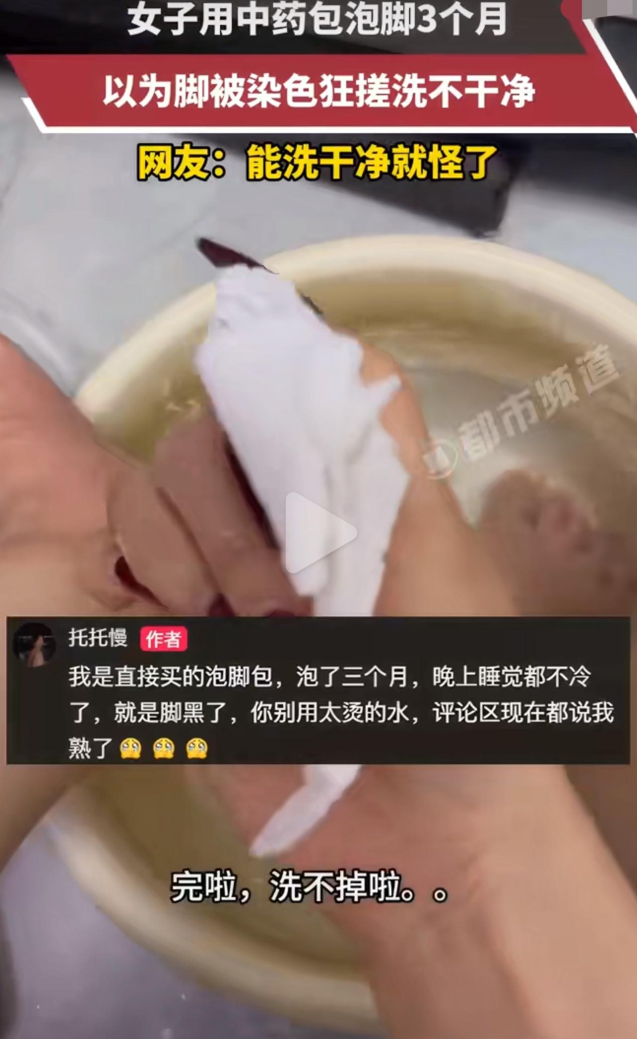 江苏一姐妹坚持高温热水配中药包泡脚三个月，双脚全是棕褐色斑块，使劲搓都没用，去医