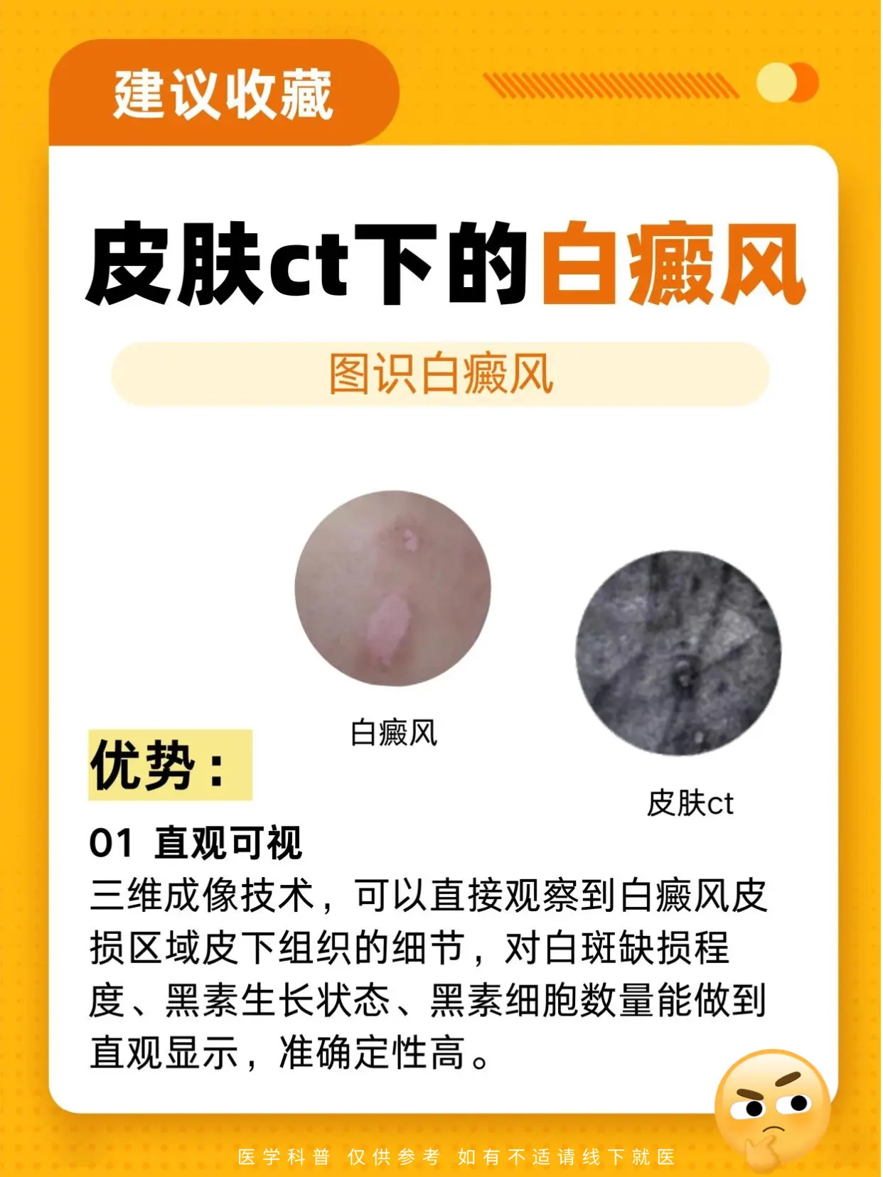 医学科普 白癜风 白癜风科普 硬核健康科普行动  白斑