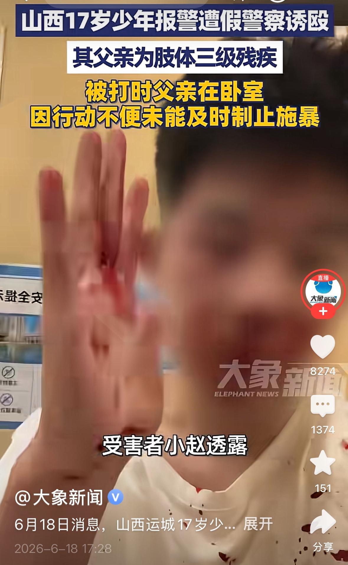 这不是一般的恶！山西运城一名17岁少年两度被一名高三学生暴力殴打，其中第二次是在