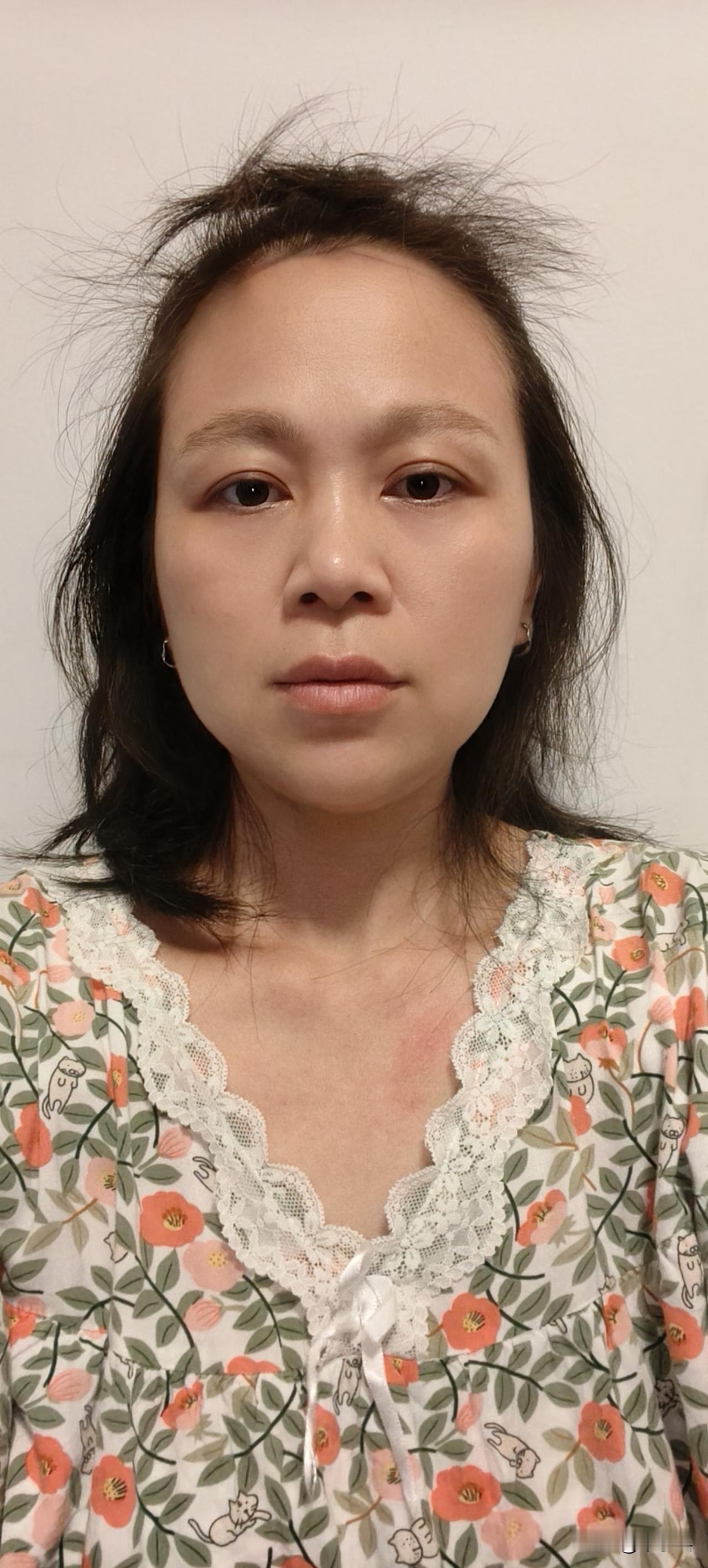 昨天又自我内耗，自我折磨，自我摧残了一宿，早上醒来睡眼朦胧，头昏脑胀，没睡好的表