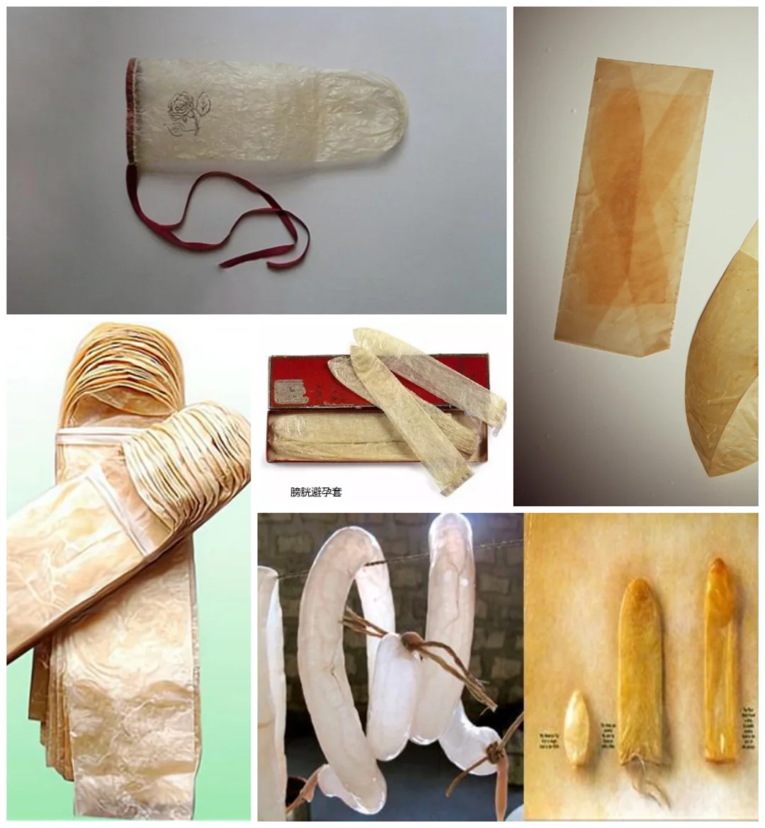 我说用鱼鳔羊肠试试咋样？媳妇一巴掌过来了