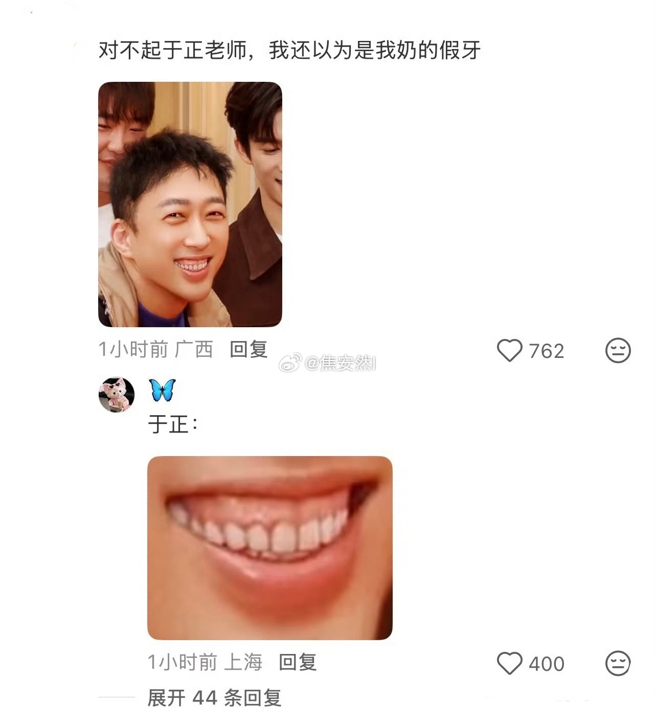 类似的牙龈我在于歪内娱妹妹那里好像也见过 