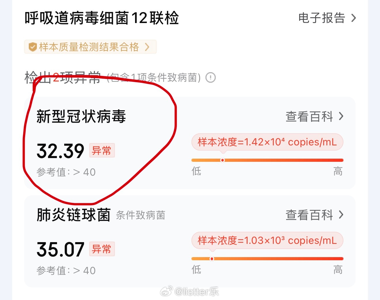 真倒霉，又感染新冠了