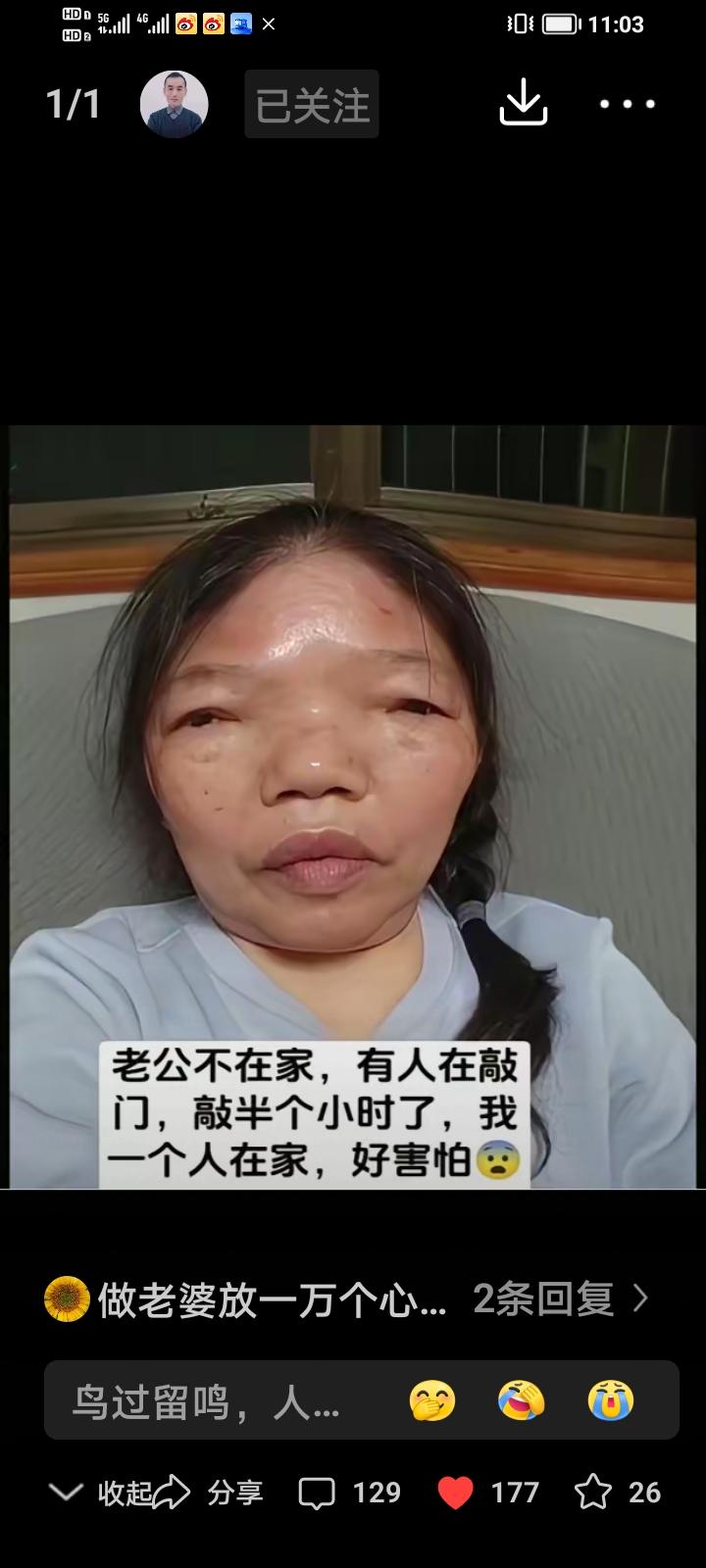 有位女子长相比较特殊，这天夜里丈夫不在家，门外有人接连敲了半小时门，她独自在家吓