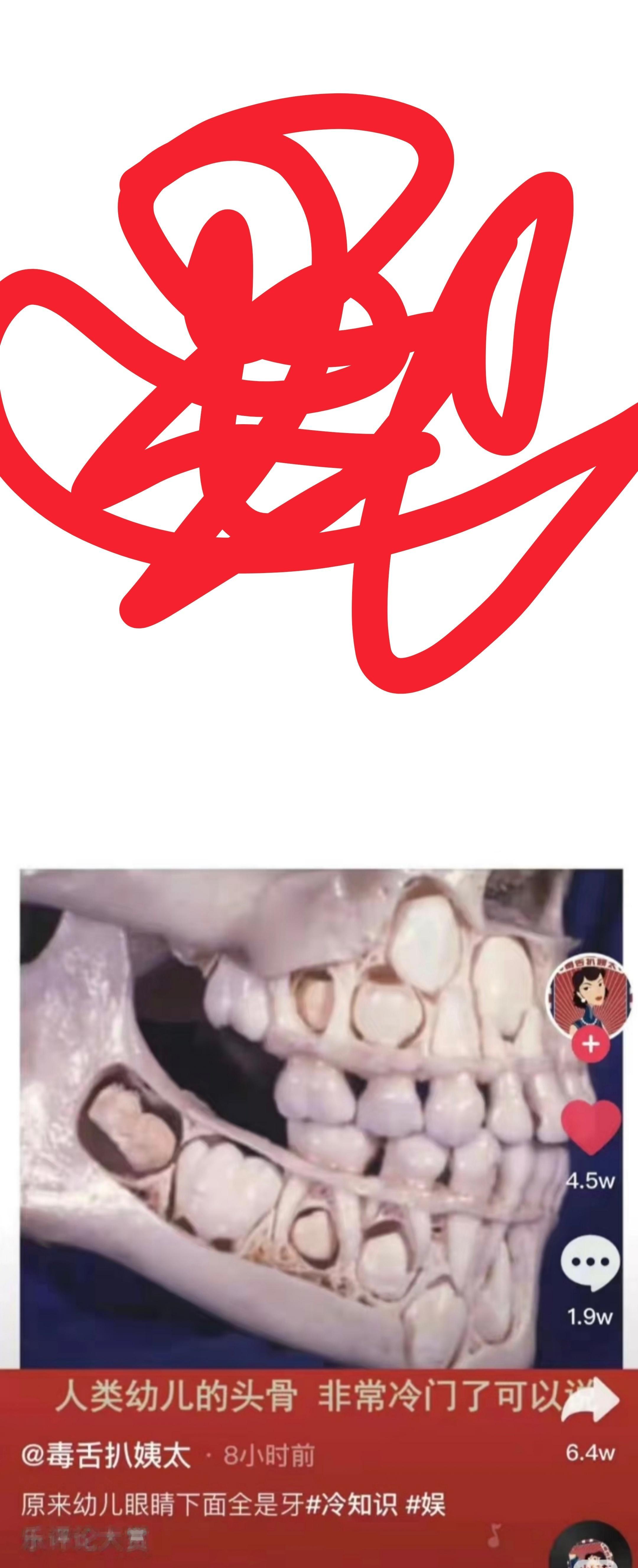 这图是真的假的，我现在San值狂掉 （略恐怖，慎点） 