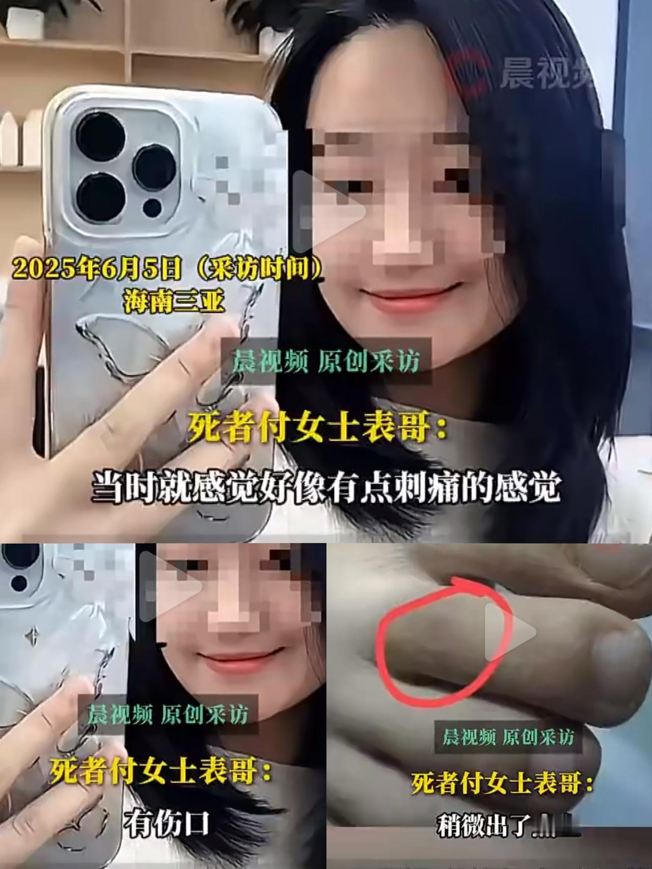 三亚27岁女游客被毒蛇咬伤身亡一事疑反转！当地卫健委通报：被咬伤近一个小时后才赶