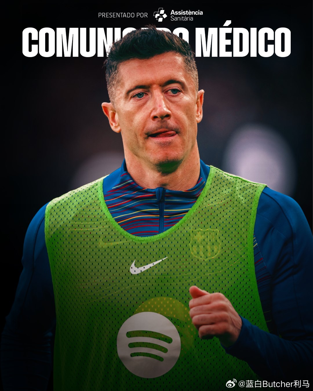 03月01日 巴萨官方消息，球队前锋莱万左眼眶内侧骨折，将缺战下周对马竞次回合的