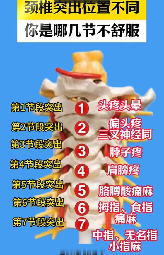 经常脖子僵硬头痛，对应颈椎突出位置自查