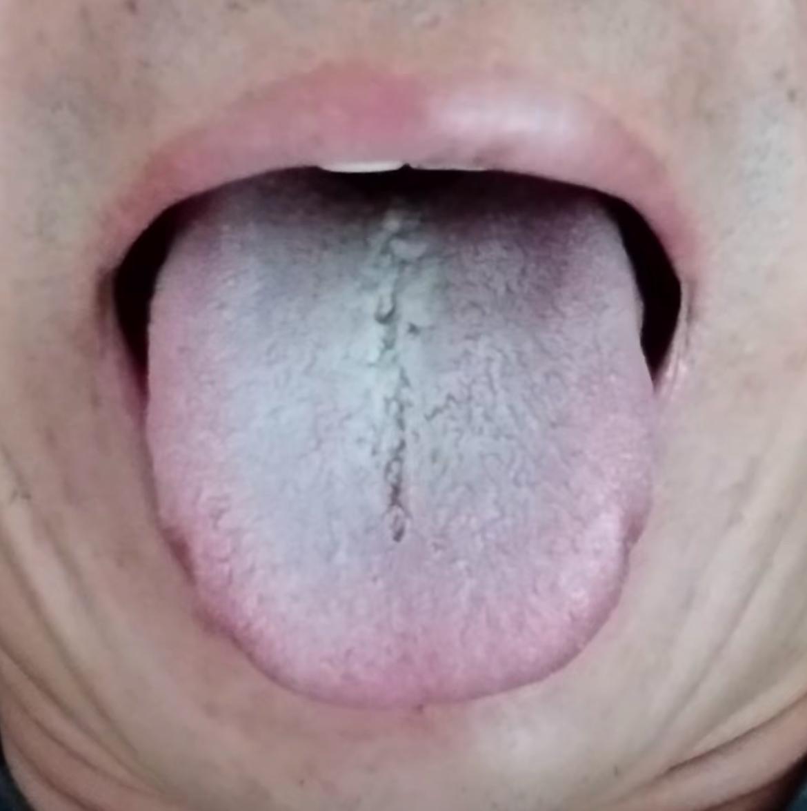 大兄弟我说真的，赶紧住手吧！用手的伤害，真的比房事伤害大[灵光一闪]

28岁的